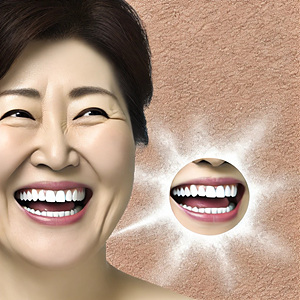 잇몸 염증 뿌리는약